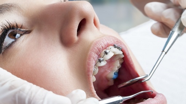 The Inside Scoop: Unleashing the Secrets of a Private Dentist