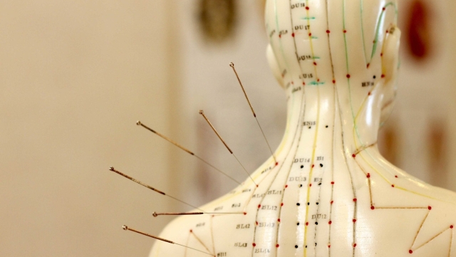 The Healing Power of Acupuncture: Unveiling Ancient Needles for Modern Wellness